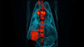 /sites/default/files/styles/listing_image/public/Understanding%20Latent%20Tuberculosis%20for%20Drug%20Discovery?itok=JNMjgisd